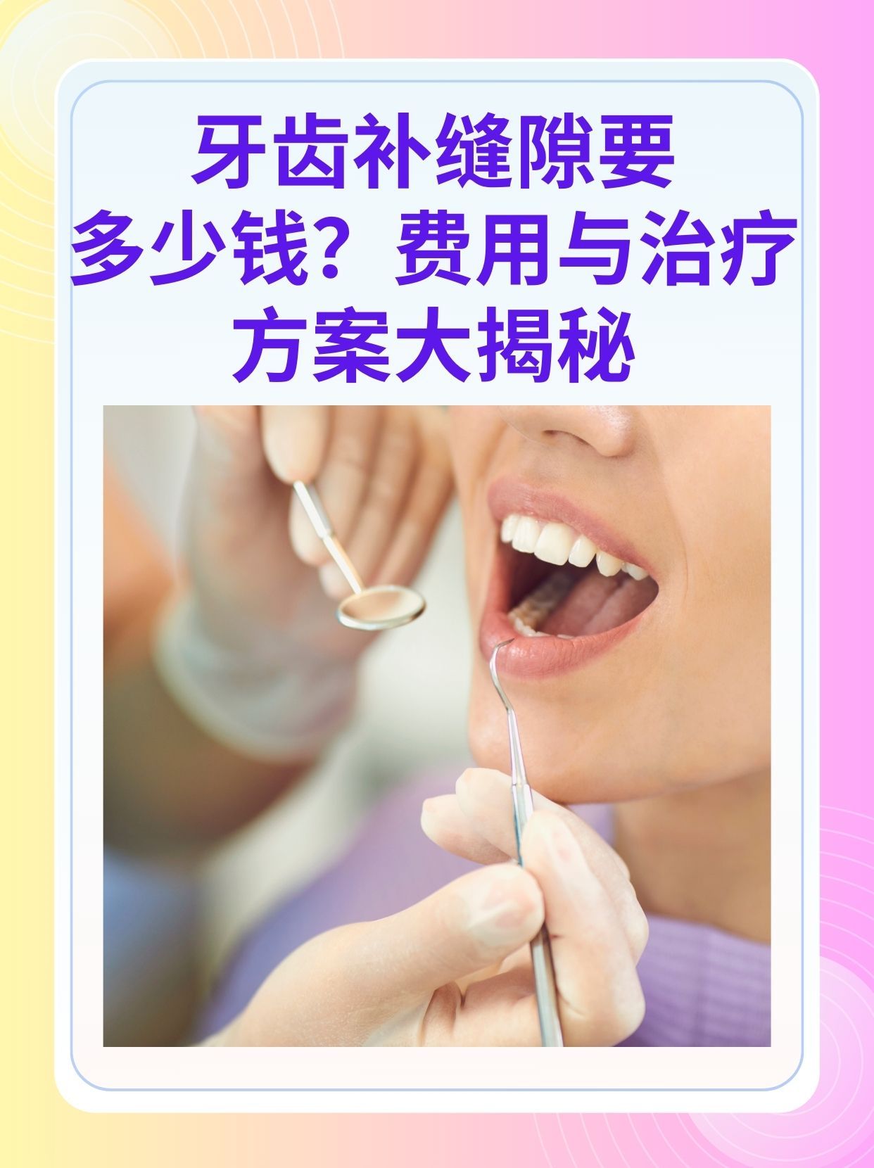 新疆补牙医保可以报销吗(补牙医保可以报销吗 哪些可以报销呢)